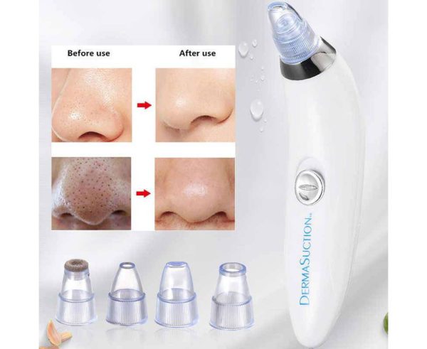 Blackhead Remover Device